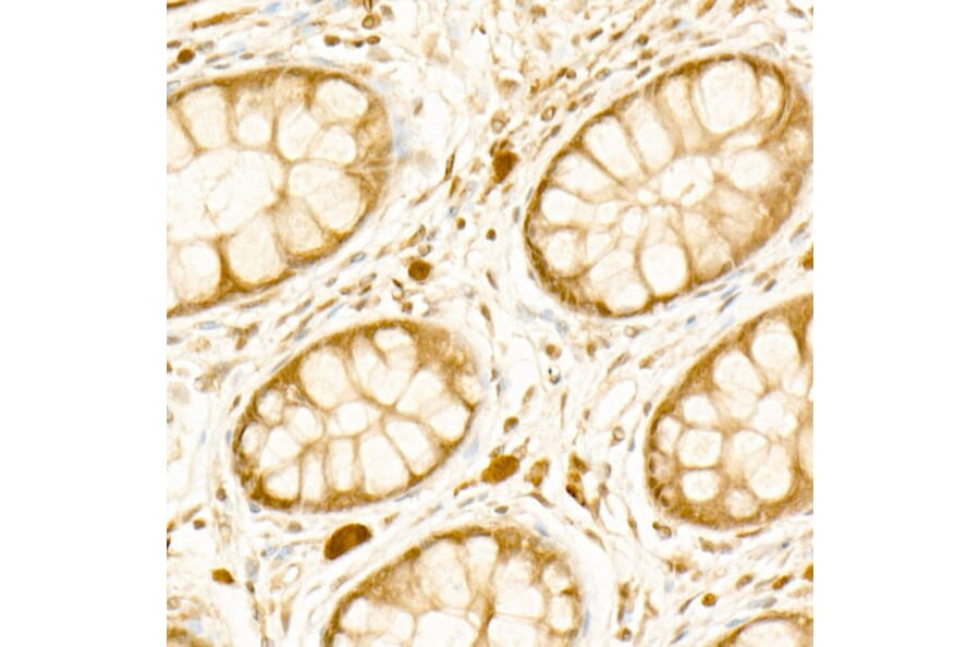 Immunohistochemistry - Anti-PI3 Kinase p110 beta Antibody [ARC54484] (A306499) - Antibodies.com