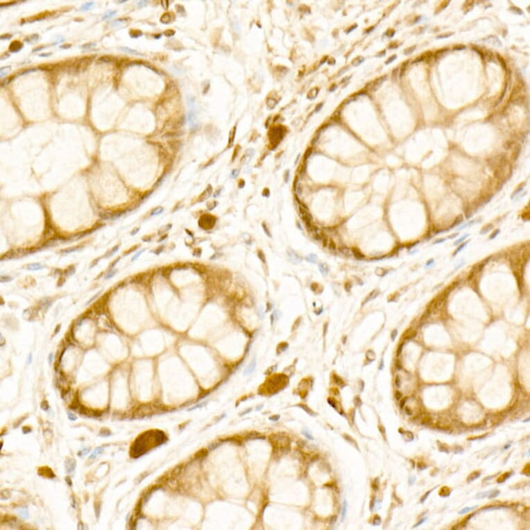 Immunohistochemistry - Anti-PI3 Kinase p110 beta Antibody [ARC54484] (A306499) - Antibodies.com