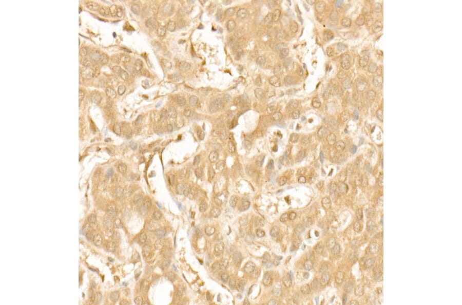 Immunohistochemistry - Anti-PI3 Kinase p110 beta Antibody [ARC54484] (A306499) - Antibodies.com