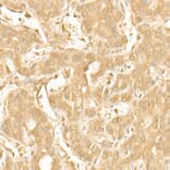 Immunohistochemistry - Anti-PI3 Kinase p110 beta Antibody [ARC54484] (A306499) - Antibodies.com