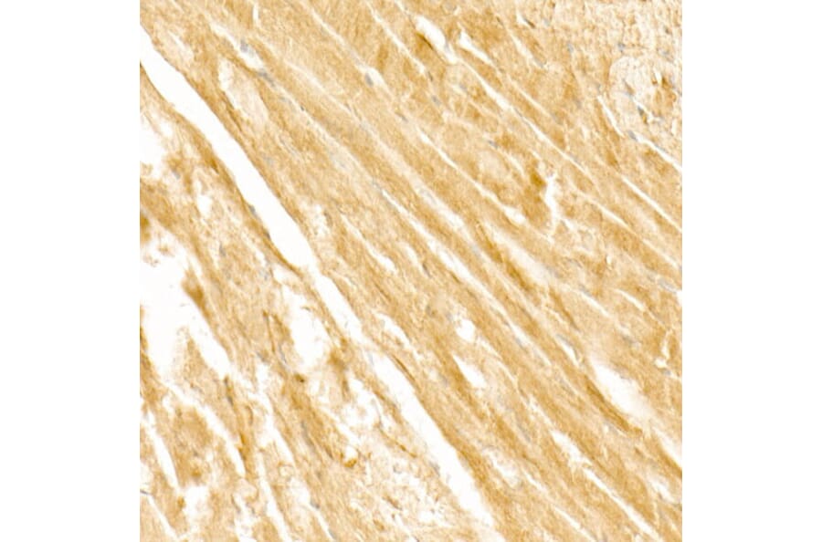 Immunohistochemistry - Anti-PI3 Kinase p110 beta Antibody [ARC54484] (A306499) - Antibodies.com