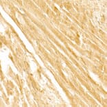 Immunohistochemistry - Anti-PI3 Kinase p110 beta Antibody [ARC54484] (A306499) - Antibodies.com