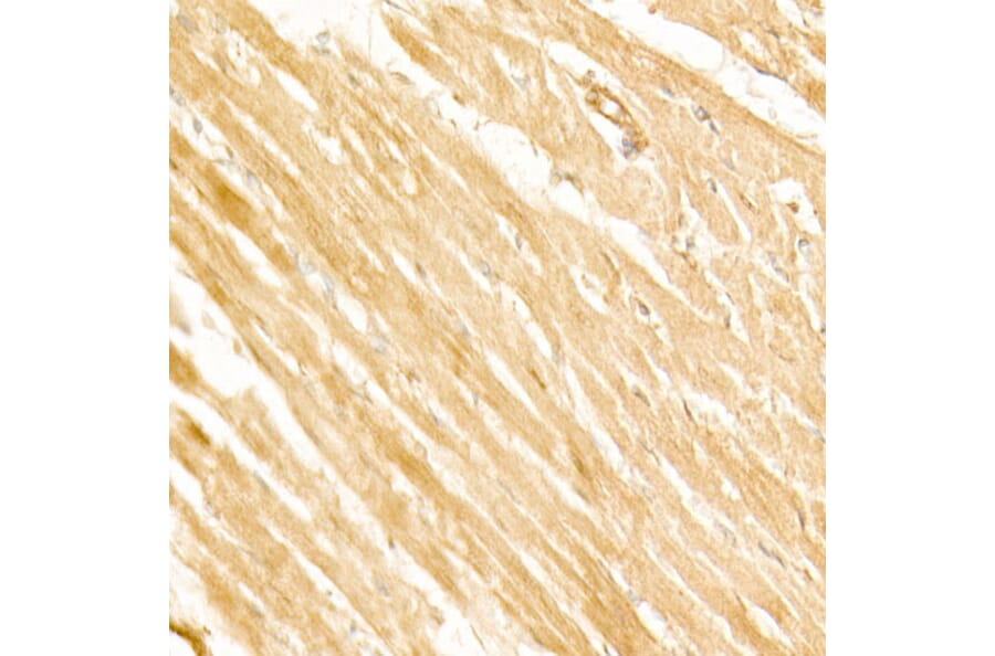 Immunohistochemistry - Anti-PI3 Kinase p110 beta Antibody [ARC54484] (A306499) - Antibodies.com