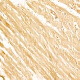 Immunohistochemistry - Anti-PI3 Kinase p110 beta Antibody [ARC54484] (A306499) - Antibodies.com