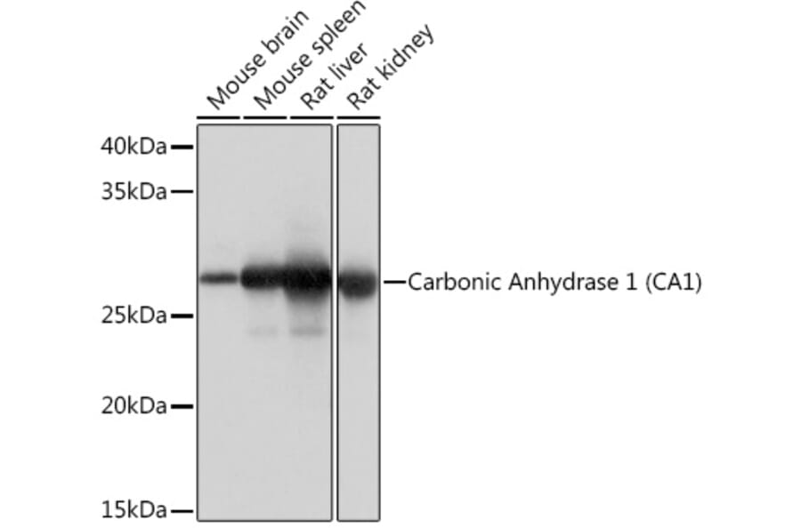 Western Blot - Anti-Carbonic Anhydrase 1/CA1 Antibody [ARC1062] (A306500) - Antibodies.com