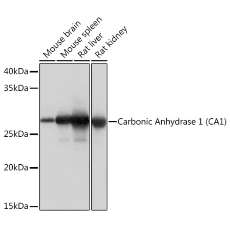 Western Blot - Anti-Carbonic Anhydrase 1/CA1 Antibody [ARC1062] (A306500) - Antibodies.com