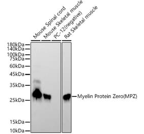 Western Blot - Anti-Myelin Protein Zero Antibody [ARC53696] (A306501) - Antibodies.com