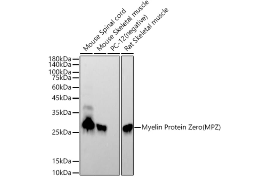 Western Blot - Anti-Myelin Protein Zero Antibody [ARC53696] (A306501) - Antibodies.com