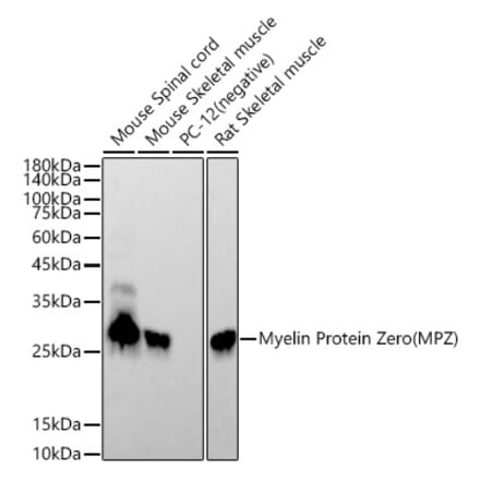 Western Blot - Anti-Myelin Protein Zero Antibody [ARC53696] (A306501) - Antibodies.com