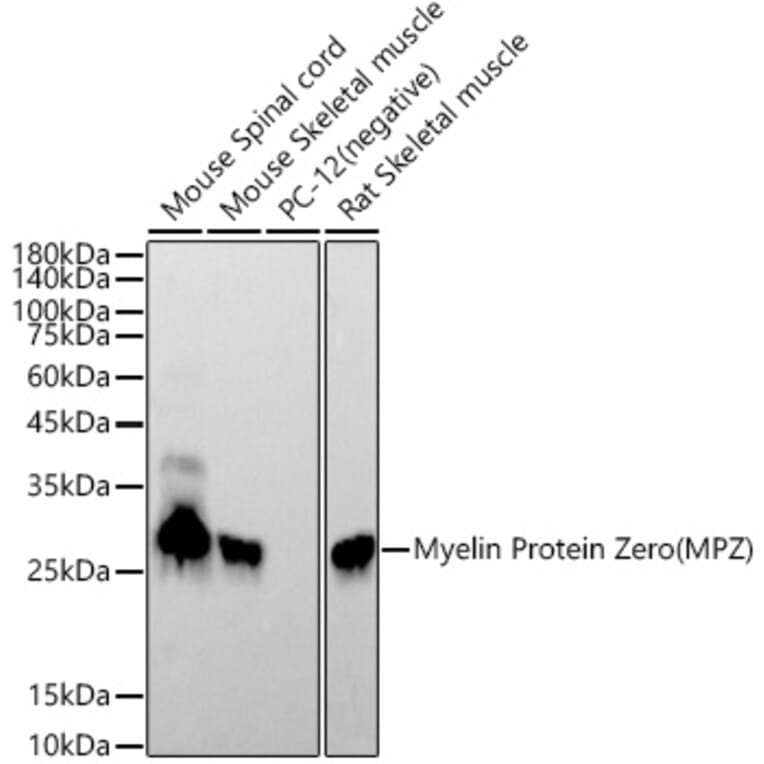 Western Blot - Anti-Myelin Protein Zero Antibody [ARC53696] (A306501) - Antibodies.com