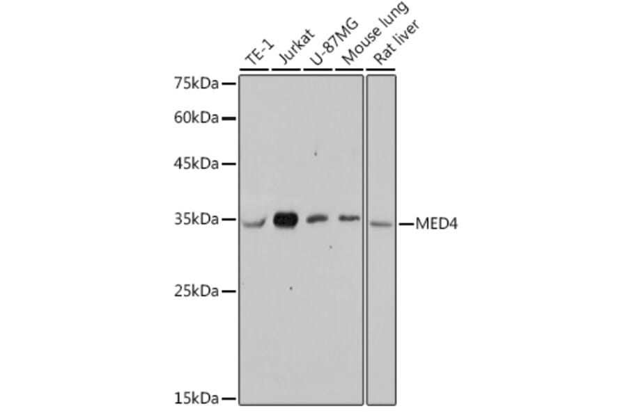 Western Blot - Anti-MED4 Antibody [ARC2528] (A306502) - Antibodies.com