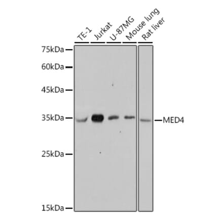 Western Blot - Anti-MED4 Antibody [ARC2528] (A306502) - Antibodies.com