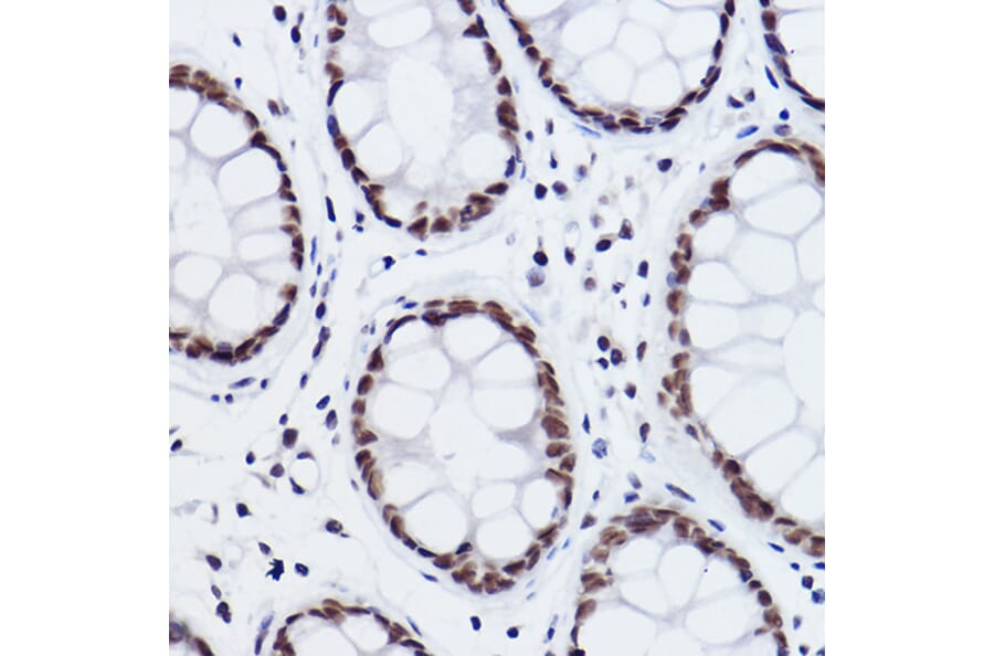 Immunohistochemistry - Anti-MED4 Antibody [ARC2528] (A306502) - Antibodies.com