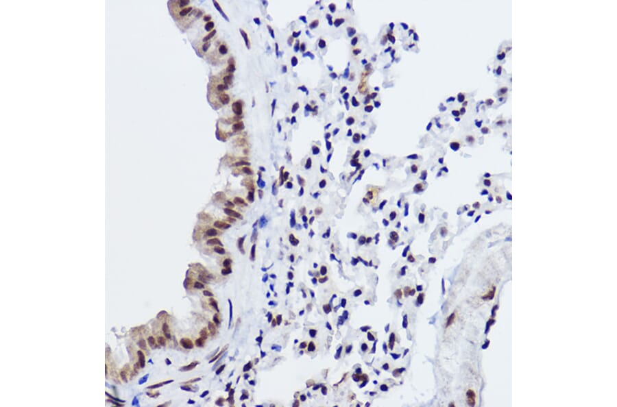 Immunohistochemistry - Anti-MED4 Antibody [ARC2528] (A306502) - Antibodies.com