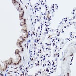 Immunohistochemistry - Anti-MED4 Antibody [ARC2528] (A306502) - Antibodies.com