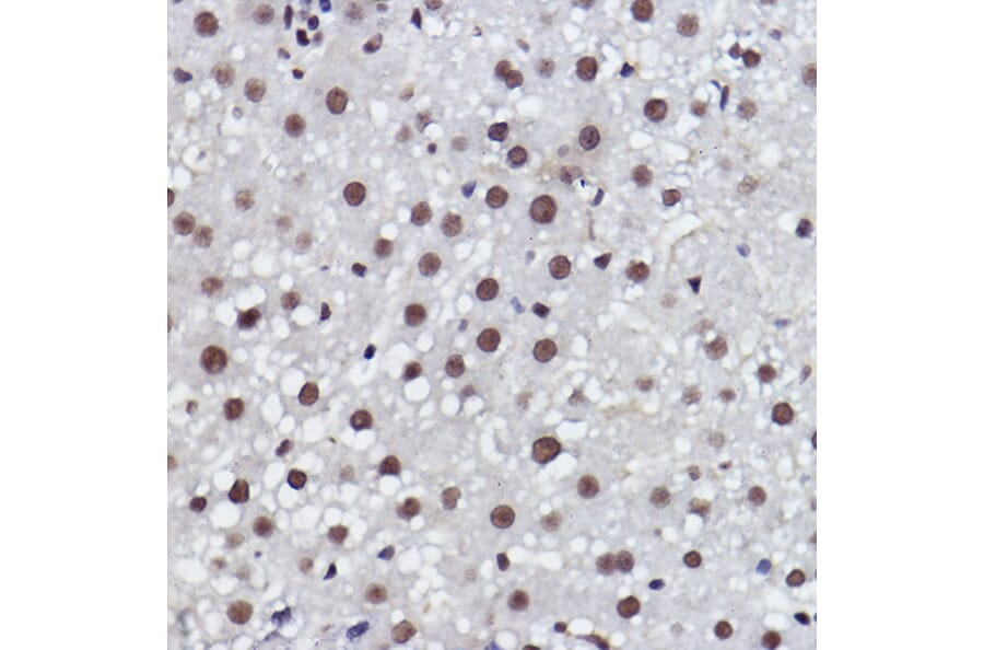 Immunohistochemistry - Anti-MED4 Antibody [ARC2528] (A306502) - Antibodies.com