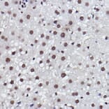 Immunohistochemistry - Anti-MED4 Antibody [ARC2528] (A306502) - Antibodies.com