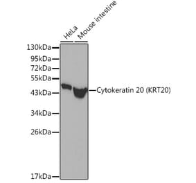 Western Blot - Anti-Cytokeratin 20 Antibody (A306504) - Antibodies.com