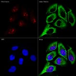 Immunofluorescence - Anti-Fibrillarin Antibody [ARC0506] (A306505) - Antibodies.com