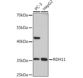 Western Blot - Anti-RDH11 Antibody (A306506) - Antibodies.com