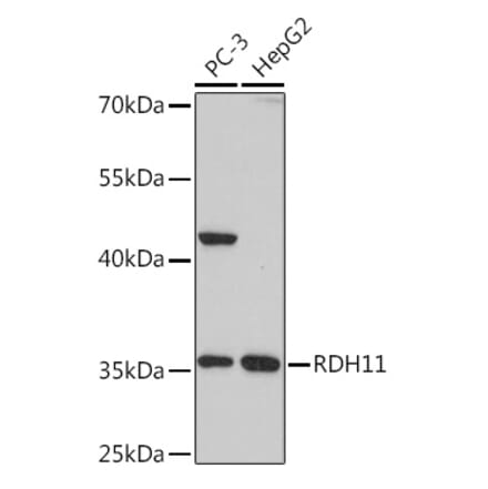 Western Blot - Anti-RDH11 Antibody (A306506) - Antibodies.com