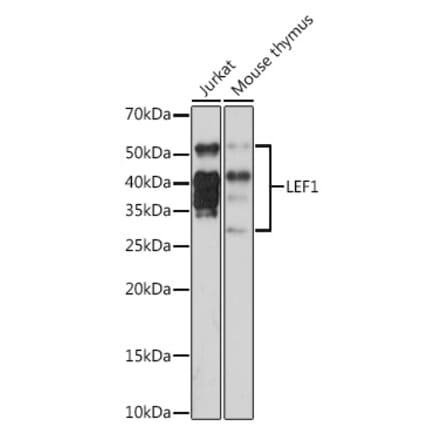 Western Blot - Anti-LEF1 Antibody [ARC1019] (A306507) - Antibodies.com