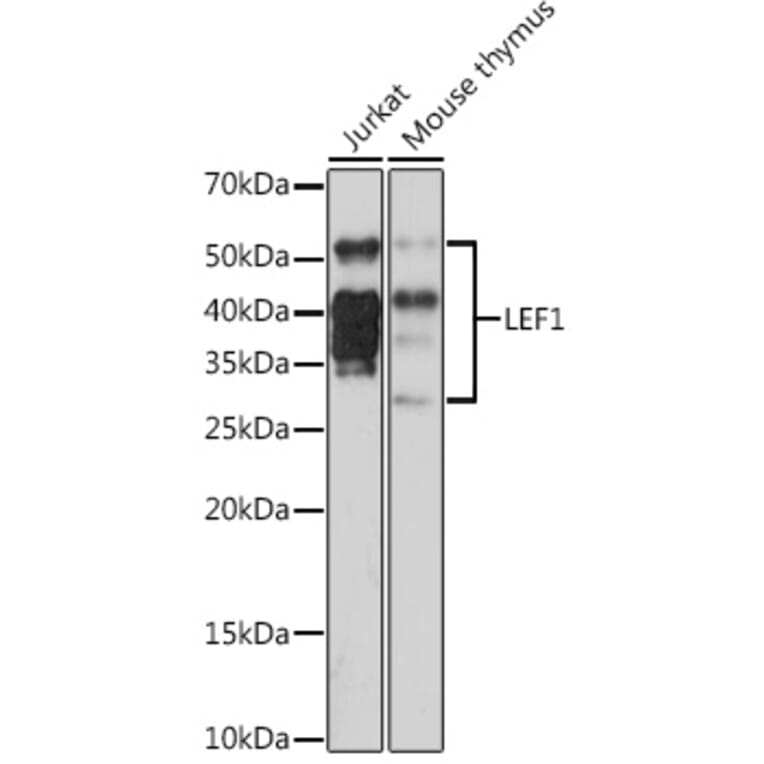 Western Blot - Anti-LEF1 Antibody [ARC1019] (A306507) - Antibodies.com