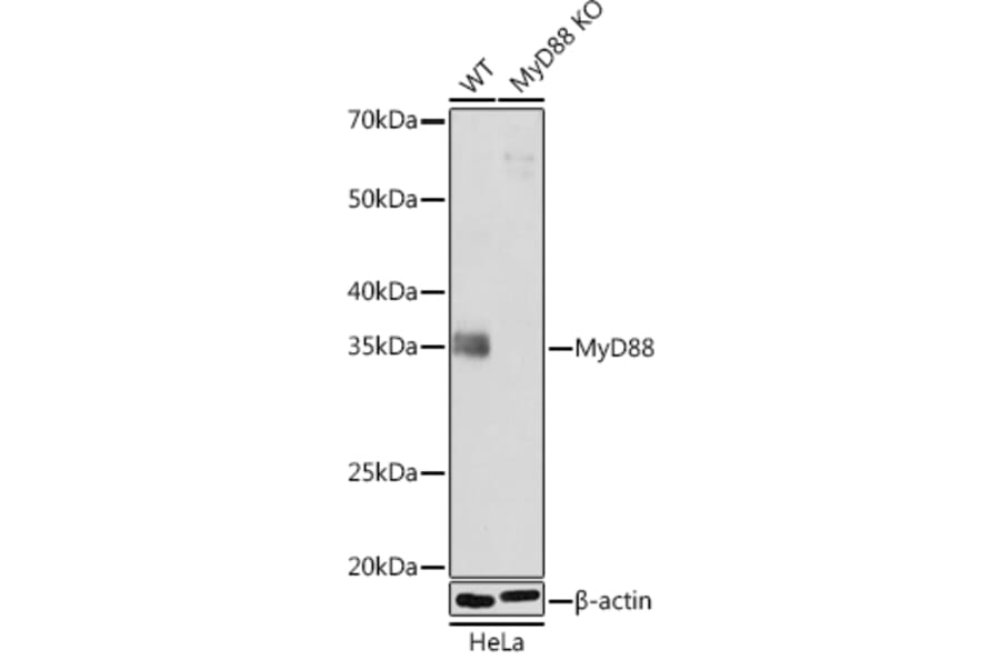 Western Blot - Anti-MyD88 Antibody [ARC52507] (A306508) - Antibodies.com