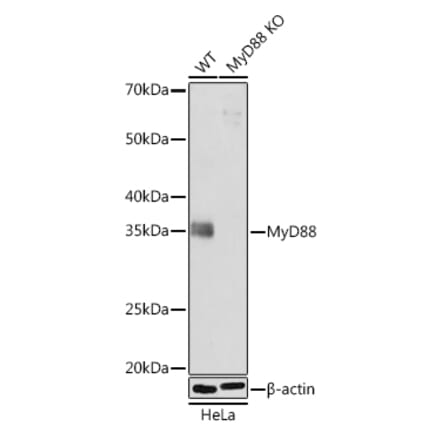 Western Blot - Anti-MyD88 Antibody [ARC52507] (A306508) - Antibodies.com
