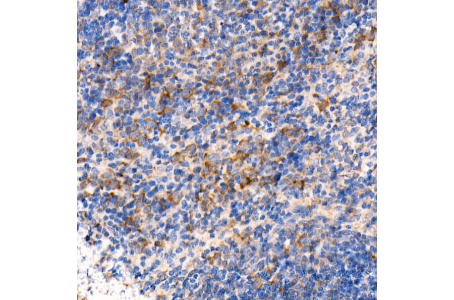 Immunohistochemistry - Anti-MyD88 Antibody [ARC52507] (A306508) - Antibodies.com