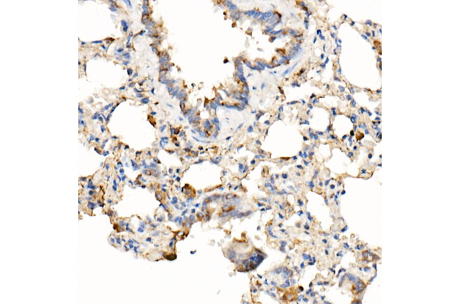 Immunohistochemistry - Anti-MyD88 Antibody [ARC52507] (A306508) - Antibodies.com