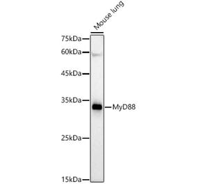 Western Blot - Anti-MyD88 Antibody [ARC52509] (A306509) - Antibodies.com