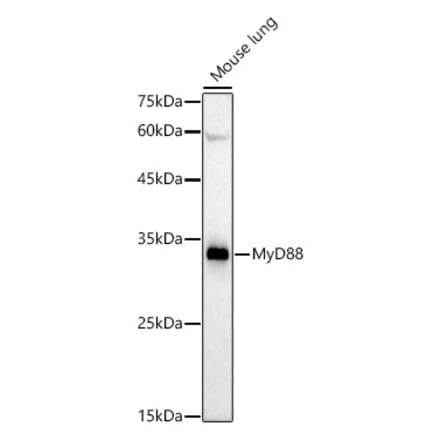 Western Blot - Anti-MyD88 Antibody [ARC52509] (A306509) - Antibodies.com