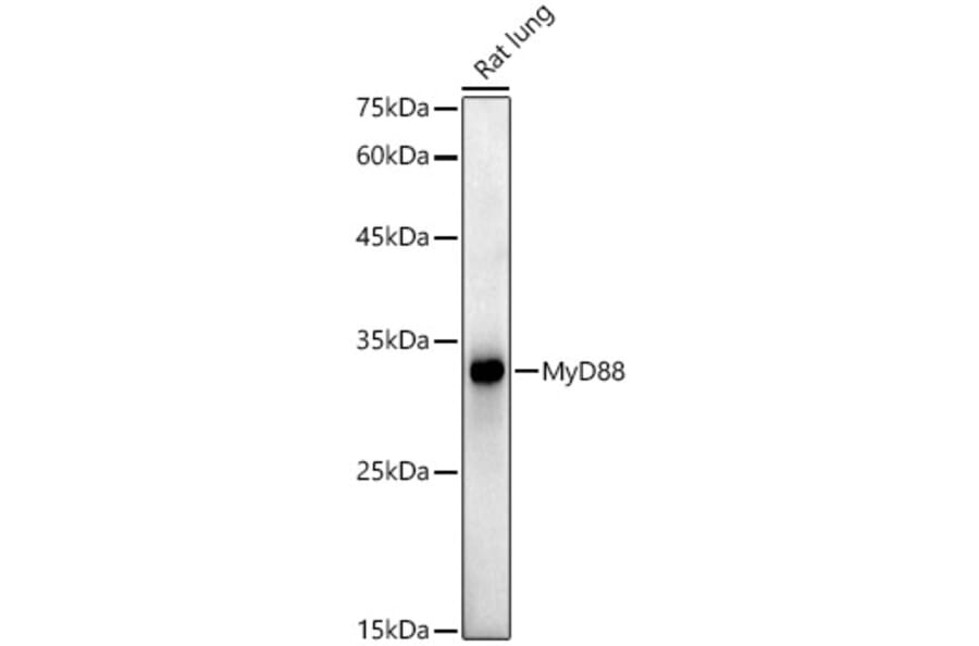 Western Blot - Anti-MyD88 Antibody [ARC52509] (A306509) - Antibodies.com