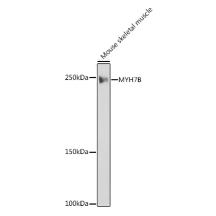 Western Blot - Anti-MYH7B Antibody [ARC2406] (A306510) - Antibodies.com