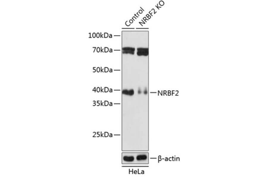 Western Blot - Anti-NRBF2 Antibody (A306512) - Antibodies.com