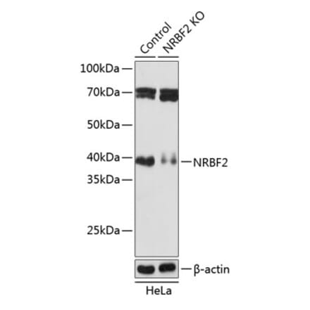 Western Blot - Anti-NRBF2 Antibody (A306512) - Antibodies.com
