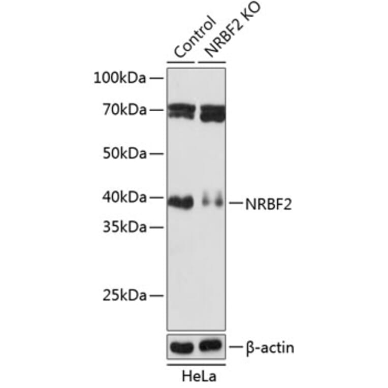 Western Blot - Anti-NRBF2 Antibody (A306512) - Antibodies.com
