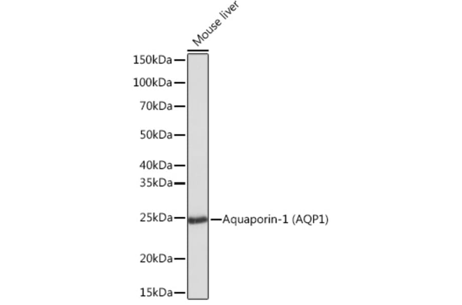 Western Blot - Anti-Aquaporin 1 Antibody [ARC0925] (A306513) - Antibodies.com