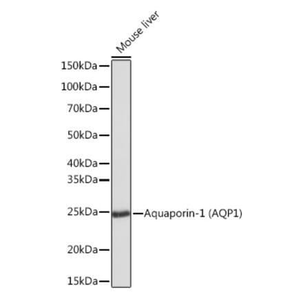 Western Blot - Anti-Aquaporin 1 Antibody [ARC0925] (A306513) - Antibodies.com