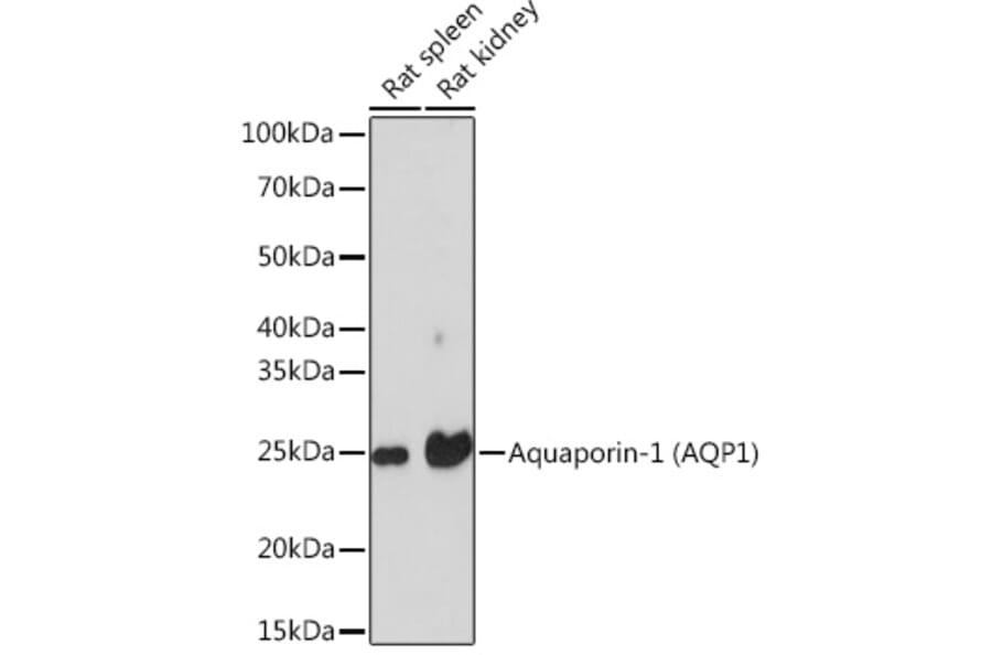 Western Blot - Anti-Aquaporin 1 Antibody [ARC0925] (A306513) - Antibodies.com