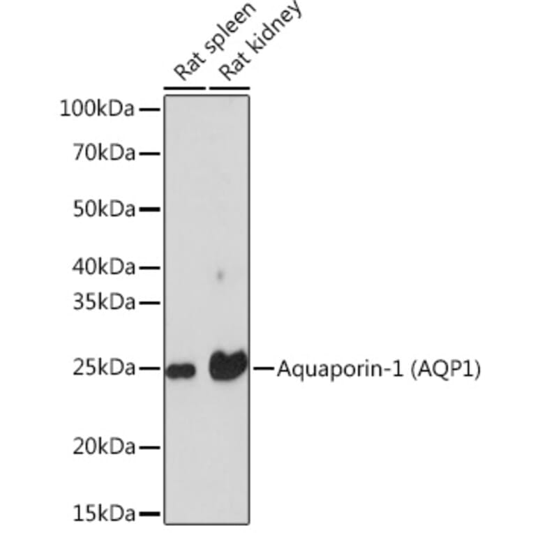Western Blot - Anti-Aquaporin 1 Antibody [ARC0925] (A306513) - Antibodies.com