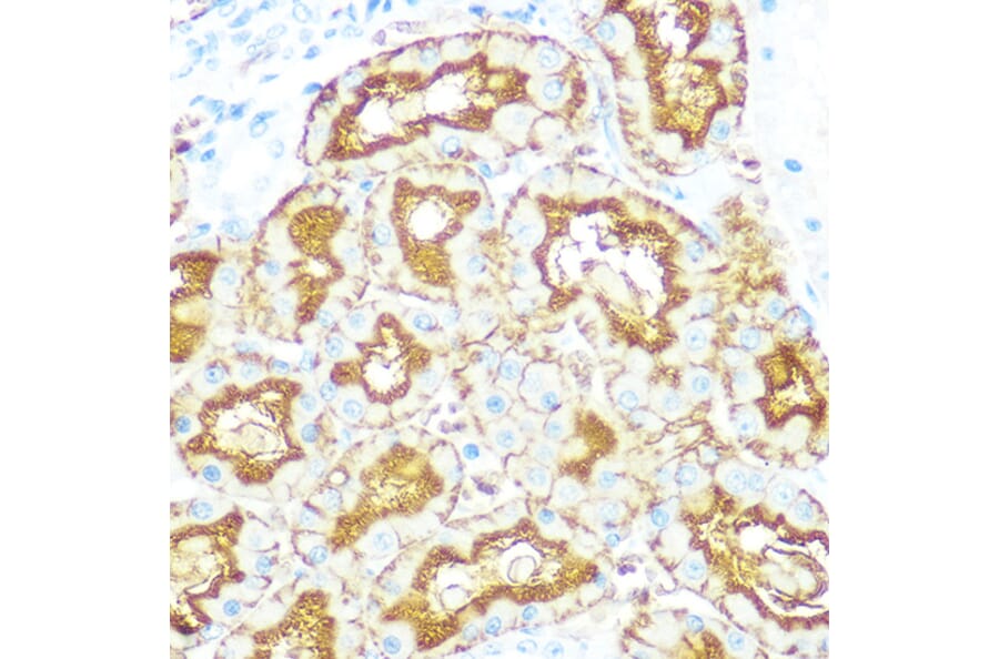 Immunohistochemistry - Anti-Aquaporin 1 Antibody [ARC0925] (A306513) - Antibodies.com