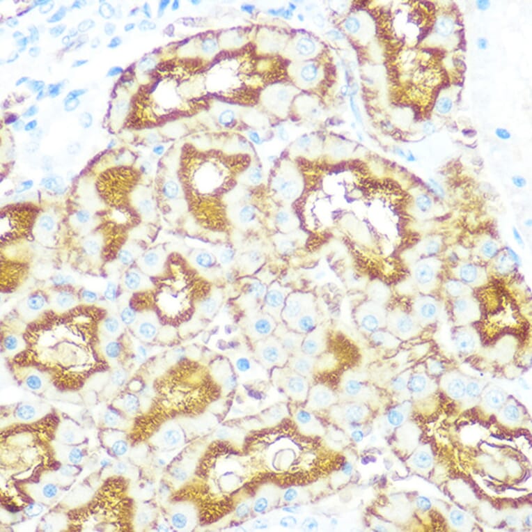 Immunohistochemistry - Anti-Aquaporin 1 Antibody [ARC0925] (A306513) - Antibodies.com