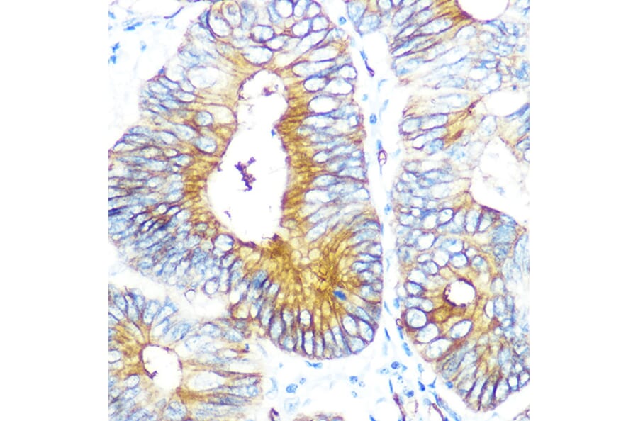 Immunohistochemistry - Anti-Aquaporin 1 Antibody [ARC0925] (A306513) - Antibodies.com