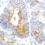 Immunohistochemistry - Anti-Aquaporin 1 Antibody [ARC0925] (A306513) - Antibodies.com