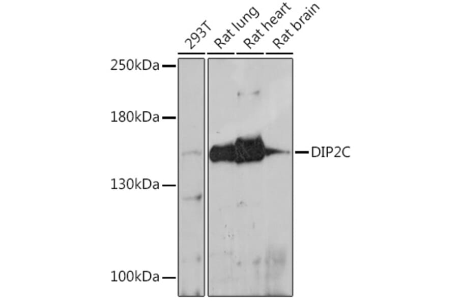 Western Blot - Anti-DIP2C Antibody (A306514) - Antibodies.com