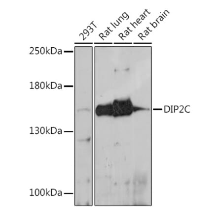 Western Blot - Anti-DIP2C Antibody (A306514) - Antibodies.com