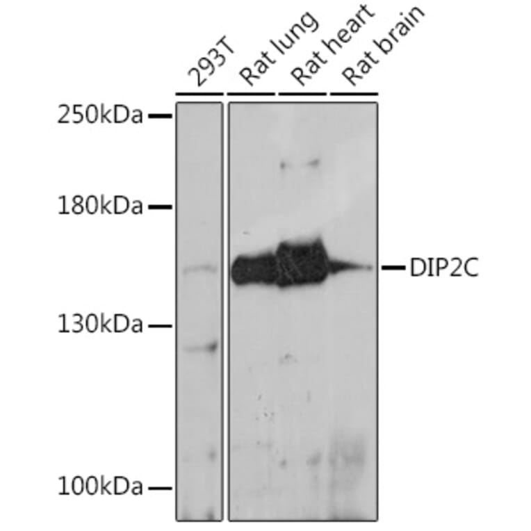 Western Blot - Anti-DIP2C Antibody (A306514) - Antibodies.com