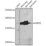 Western Blot - Anti-DIP2C Antibody (A306514) - Antibodies.com